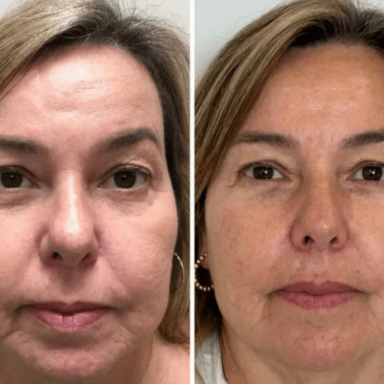 Mascarilla de Colágeno Coreana Rejuvenecedora - Collagen Fit™