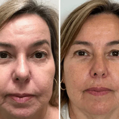 Mascarilla de Colágeno Coreana Rejuvenecedora - Collagen Fit™