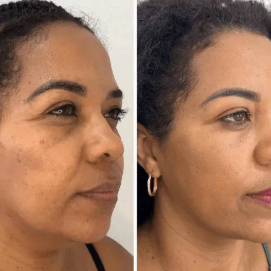Mascarilla de Colágeno Coreana Rejuvenecedora - Collagen Fit™