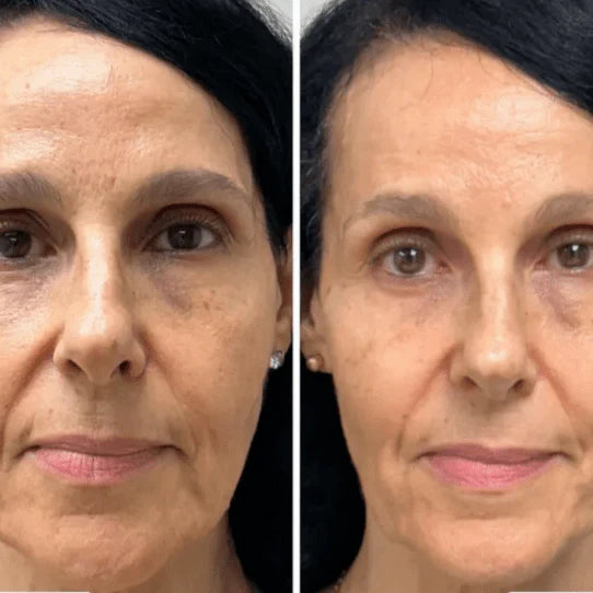 Mascarilla de Colágeno Coreana Rejuvenecedora - Collagen Fit™