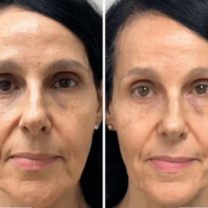 Mascarilla de Colágeno Coreana Rejuvenecedora - Collagen Fit™